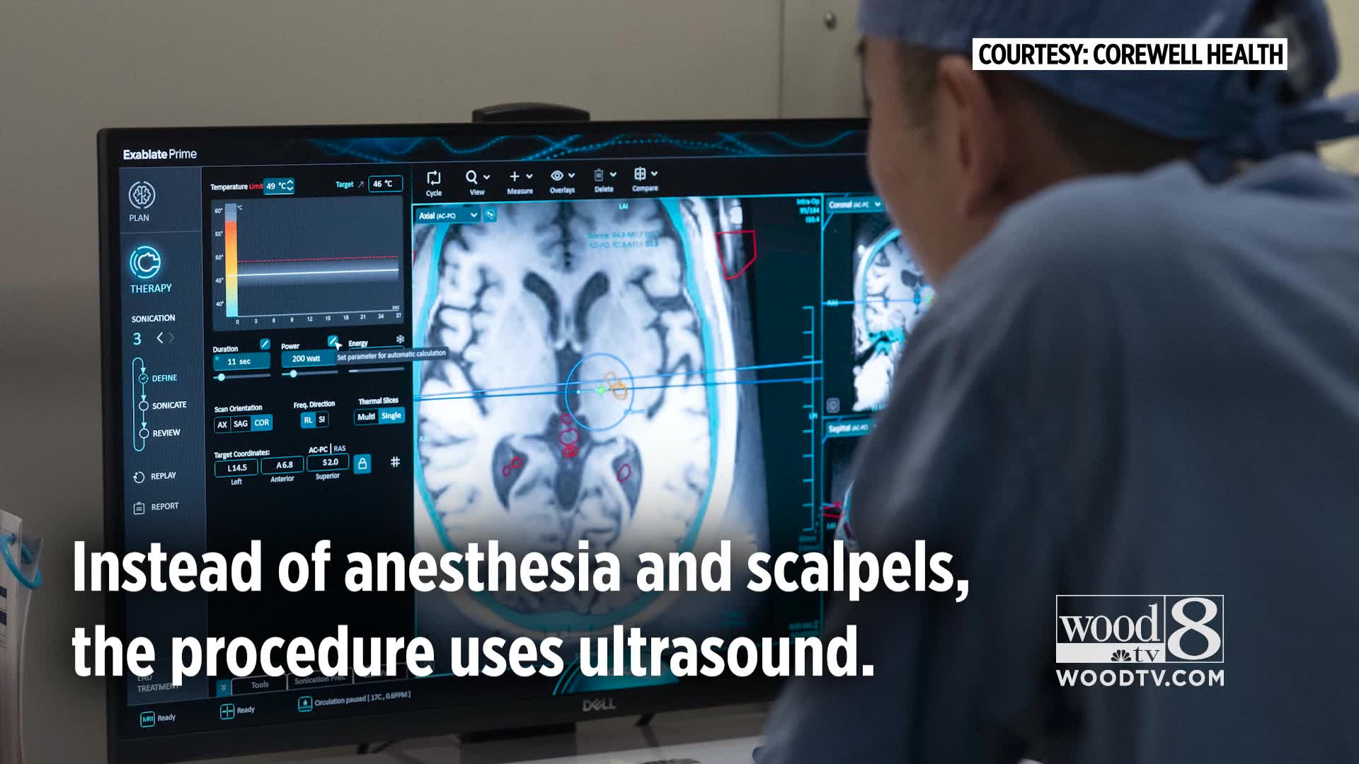 'It's remarkable': Grand Rapids doctor changing lives with brain ...